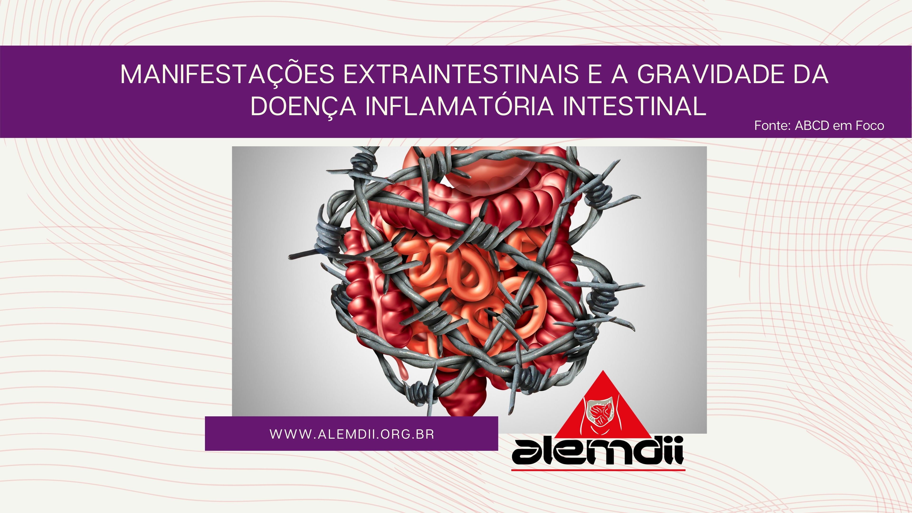 Manifestações Extraintestinais E Gravidade Da Doença Inflamatória Intestinal Br 