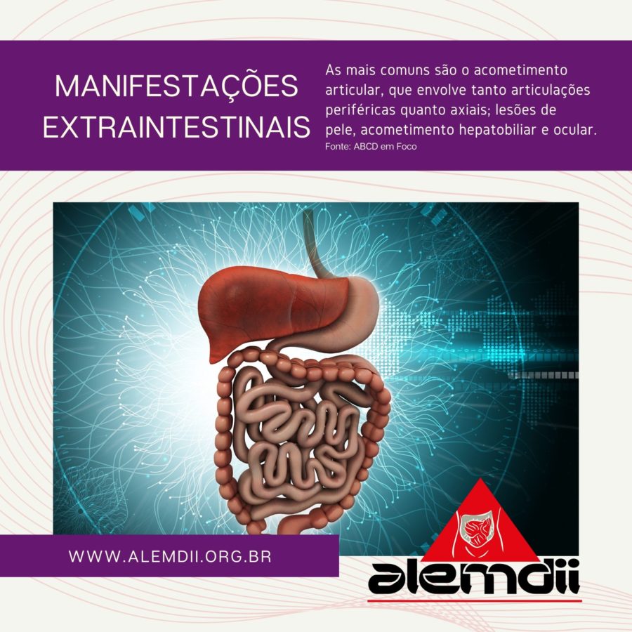 Manifestações Extraintestinais