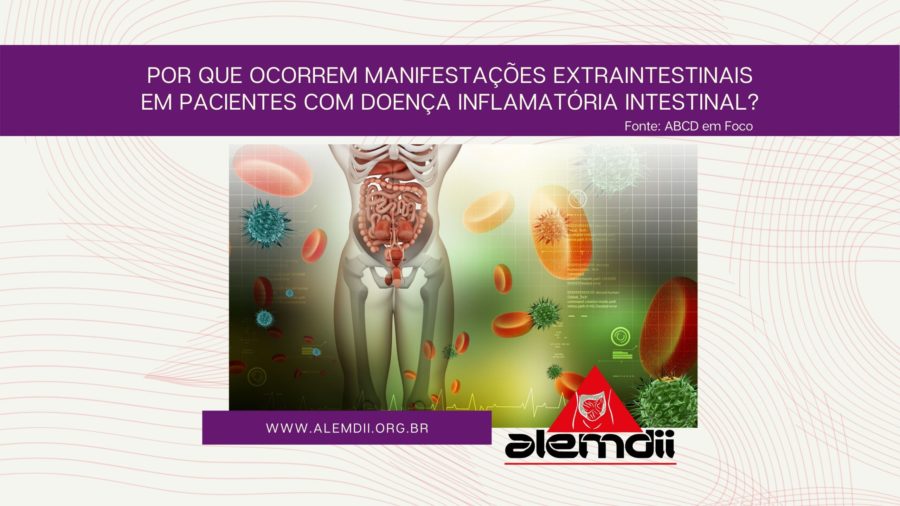 Por que ocorrem manifestações extraintestinais em pacientes com doença inflamatória intestinal?