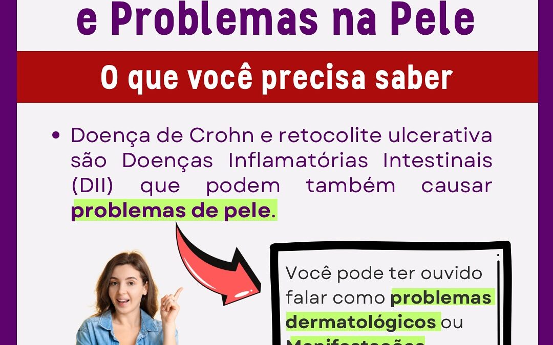 Doença Crohn, Retocolite Ulcerativa e Problemas na Pele