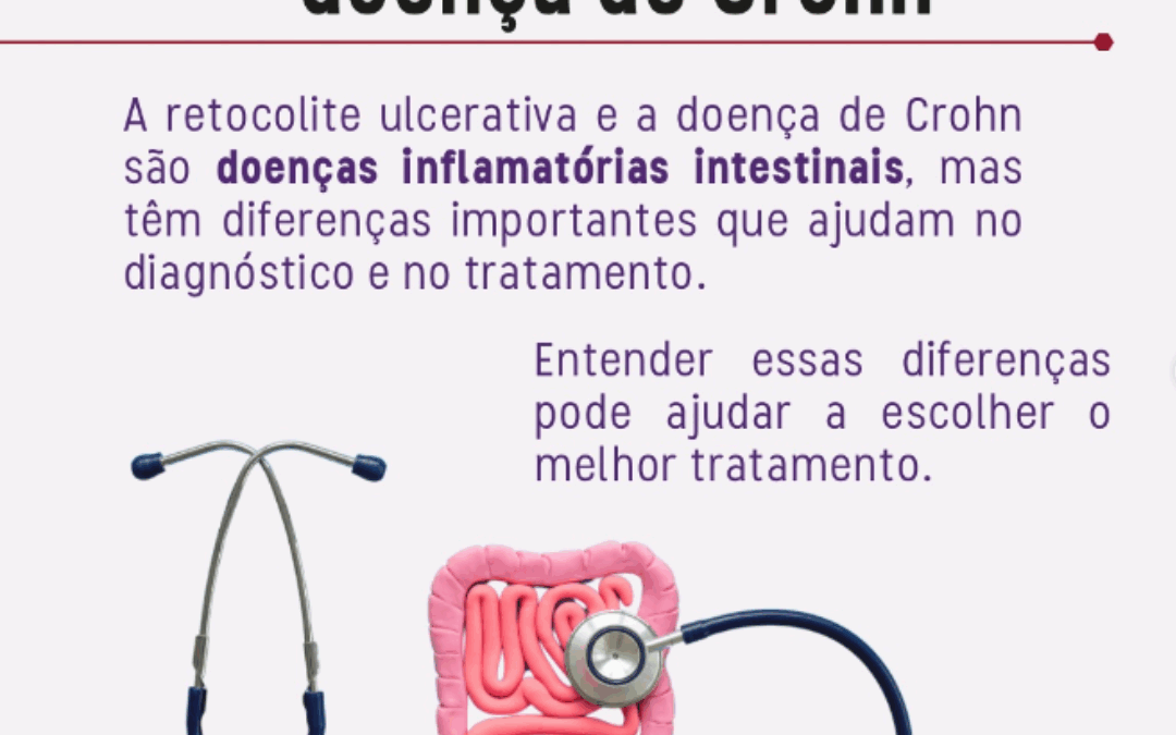 🔍 Entenda as Diferenças entre Retocolite Ulcerativa e Doença de Crohn